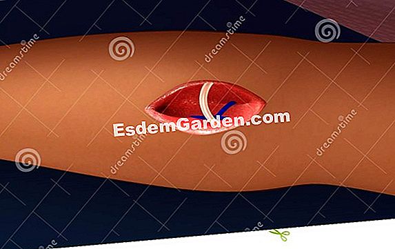 Graft scanalatura pera